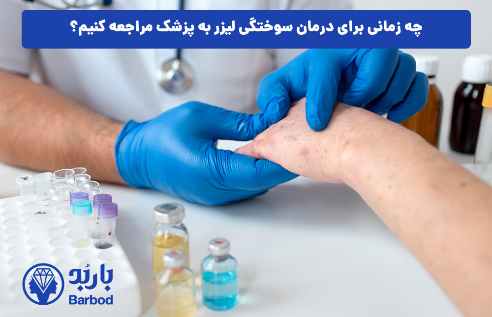 چه زمانی برای درمان سوختگی لیزر به پزشک مراجعه کنیم؟