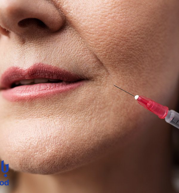 تأثیر مزوبوتاکس در کاهش و کوچک شدن منافذ پوست