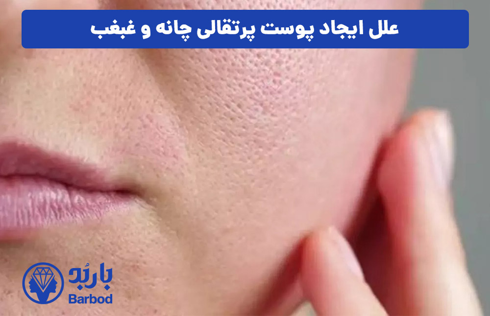 علل ایجاد پوست پرتقالی چانه و غبغب