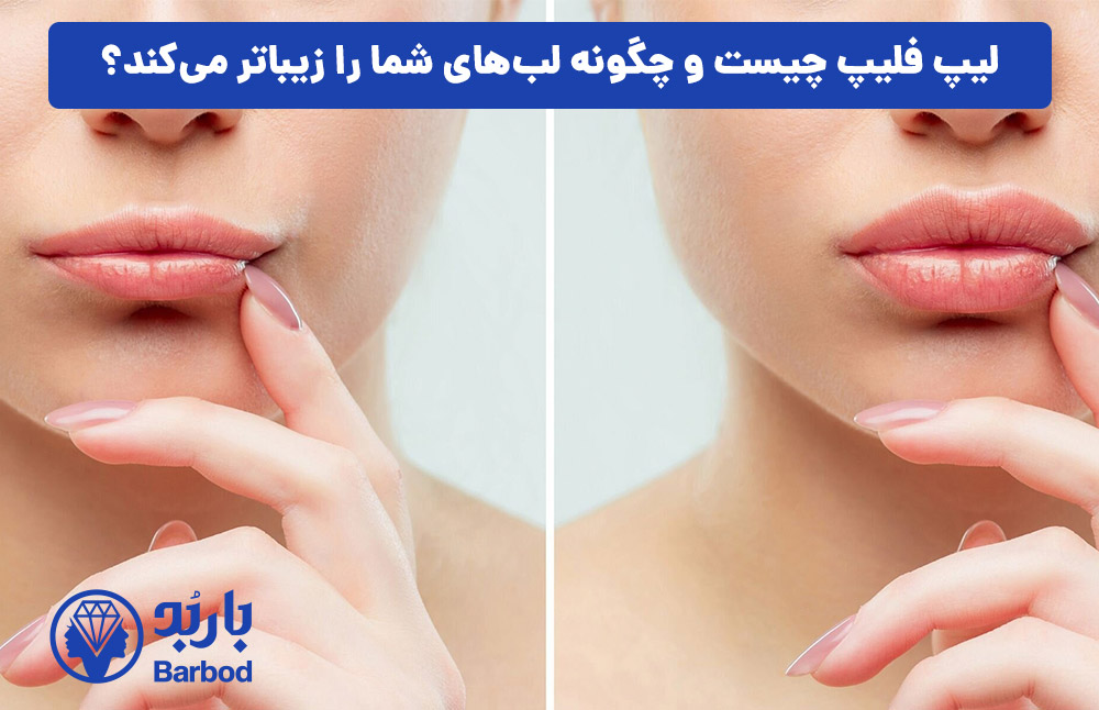 لیپ فلیپ چیست و چگونه لب‌های شما را زیباتر می‌کند؟