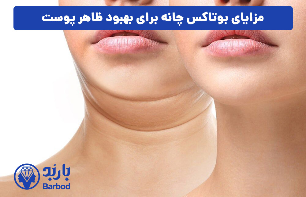 مزایای بوتاکس چانه برای بهبود ظاهر پوست