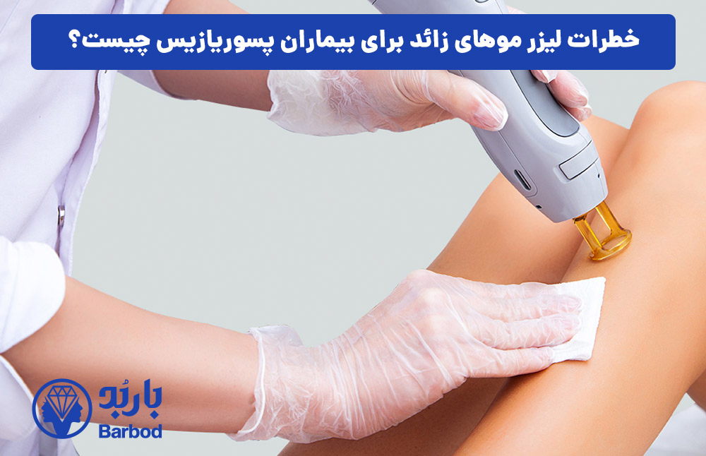 خطرات لیزر موهای زائد برای بیماران پسوریازیس چیست؟