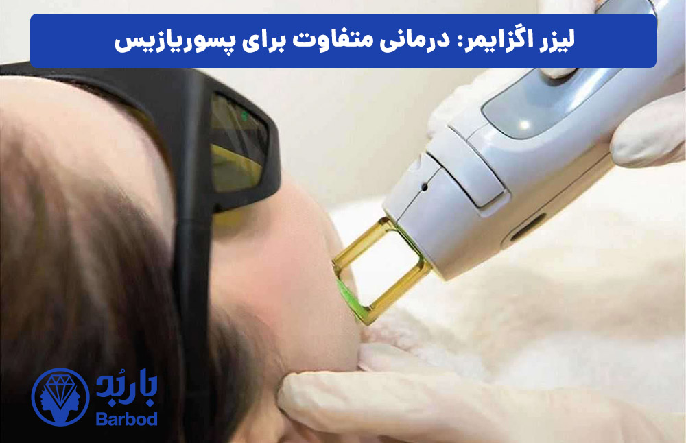 لیزر اگزایمر: درمانی متفاوت برای پسوریازیس