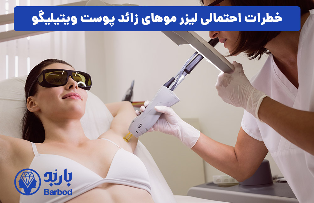 خطرات احتمالی لیزر موهای زائد پوست ویتیلیگو