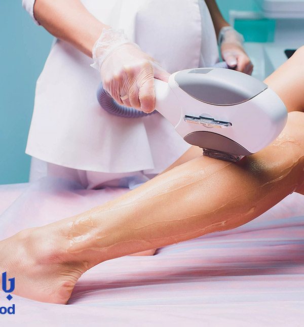 لیزر SHR چیست؟ حذف موهای زائد با جلسات کمتر در 2025