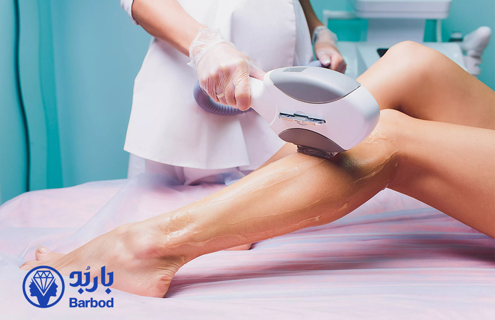لیزر SHR چیست؟ حذف موهای زائد با جلسات کمتر در 2025