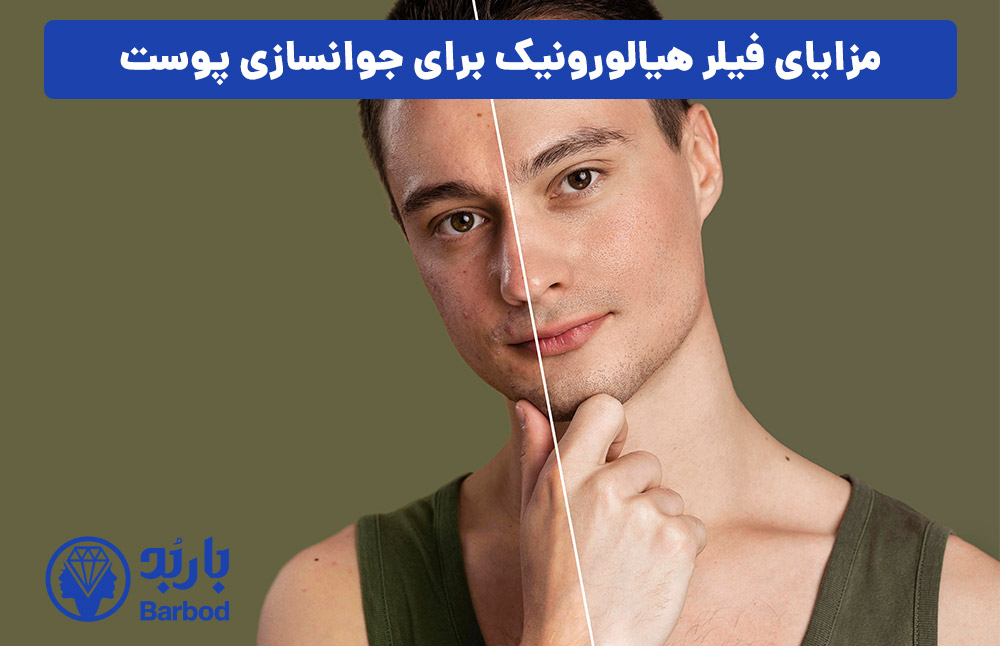 مزایای فیلر هیالورونیک برای جوانسازی پوست