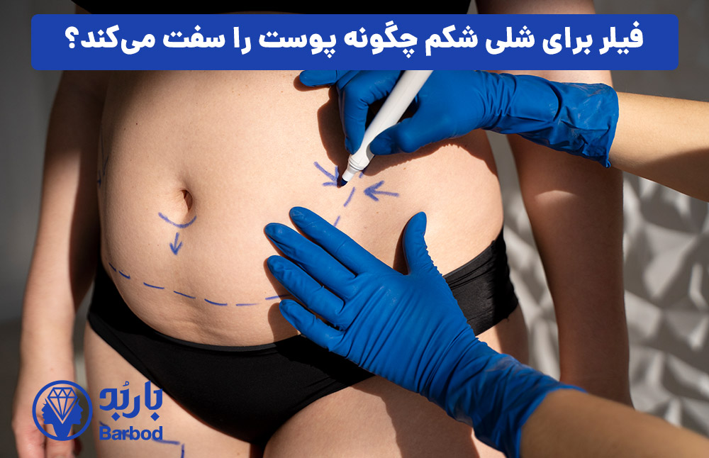 فیلر برای شلی شکم چگونه پوست را سفت می‌کند؟