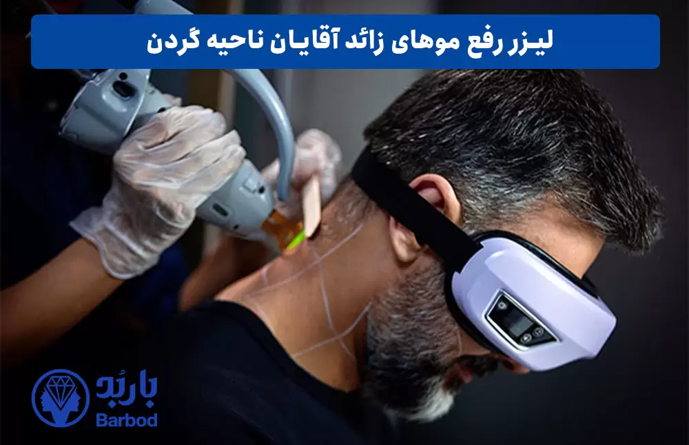 لیزر موهای زائد آقایان ناحیه گردن