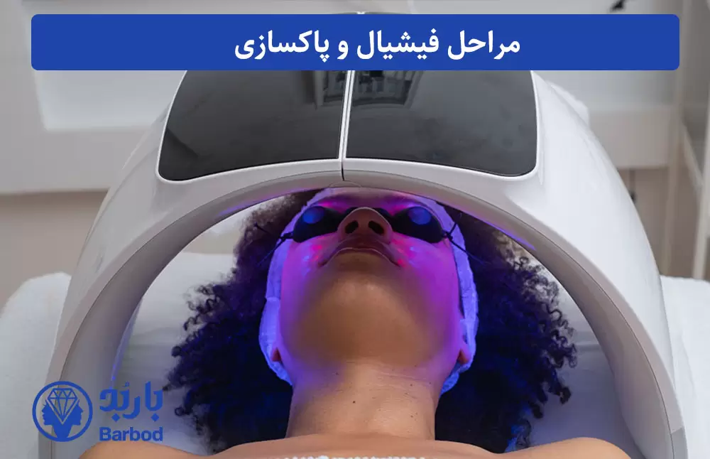 مراحل فیشیال و پاکسازی