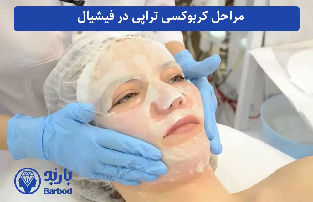 مراحل کربوکسی تراپی در فیشیال