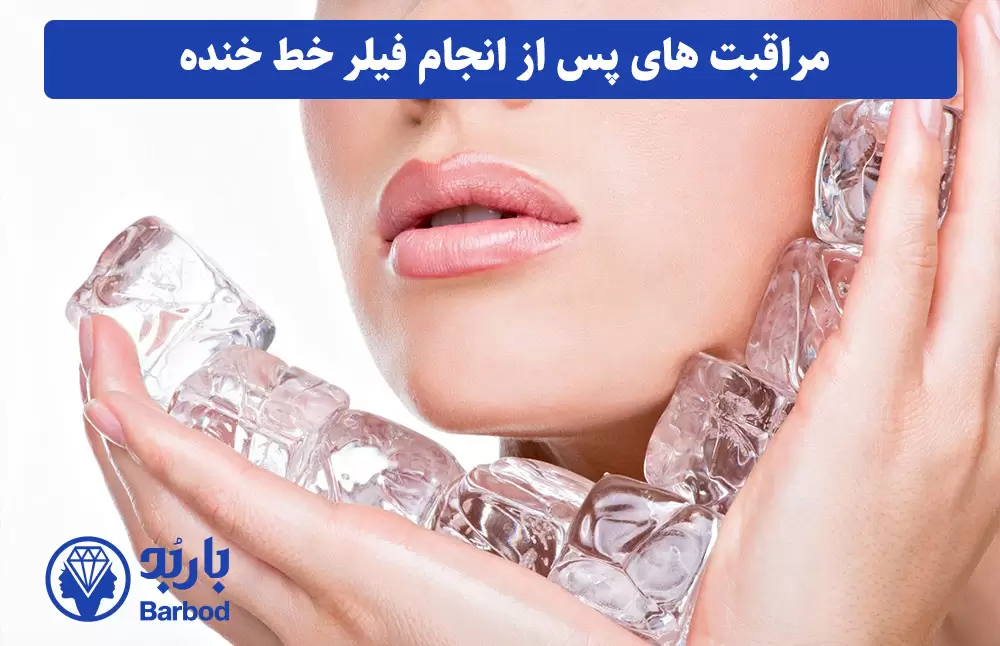 مراقبت_های-پس-از-انجام-فیلر-خط-خنده