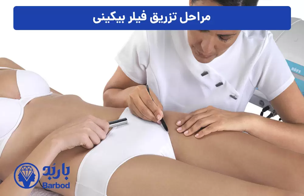 مراحل-تزریق-فیلر-بیکینی