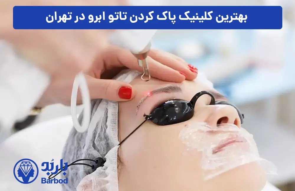 بهترین-کلینیک-پاک-کردن-تاتو-ابرو-در-تهران