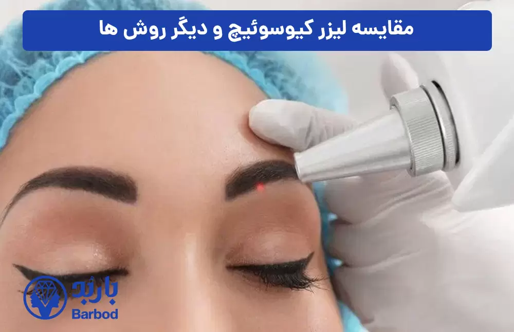 مقایسه-لیزر-کیوسوئیچ-و-دیگر-روش-ها