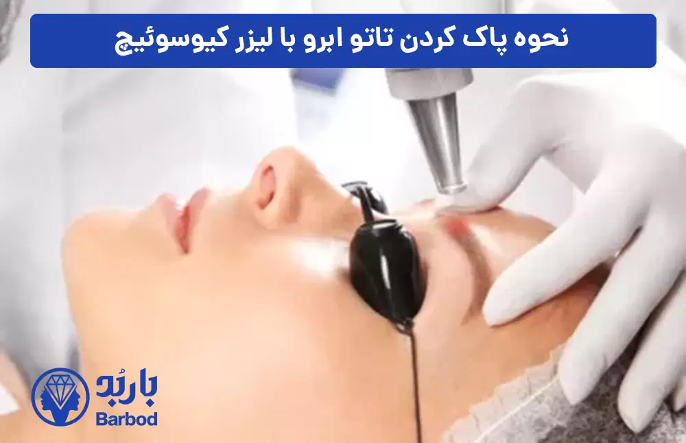 نحوه-پاک-کردن-تاتو-ابرو-با-لیزر-کیوسوئیچ