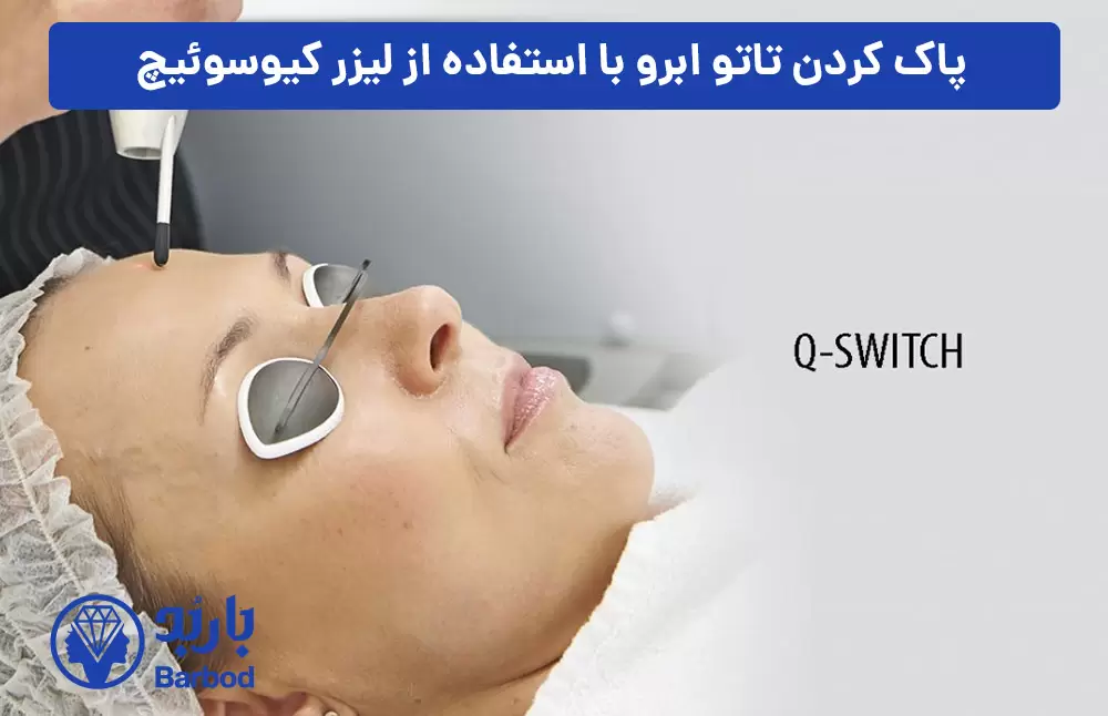 پاک-کردن-تاتو-ابرو-با-استفاده-از-لیزر-کیوسوئیچ