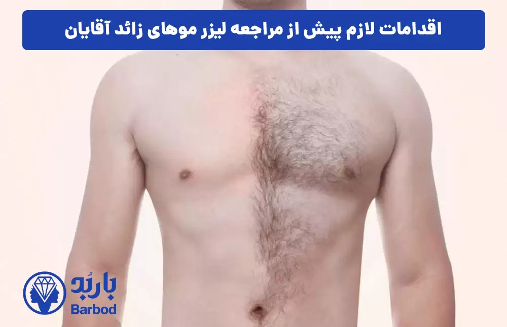 اقدامات-لازم-پیش-از-مراجعه-لیزر-موهای-زائد-آقایان