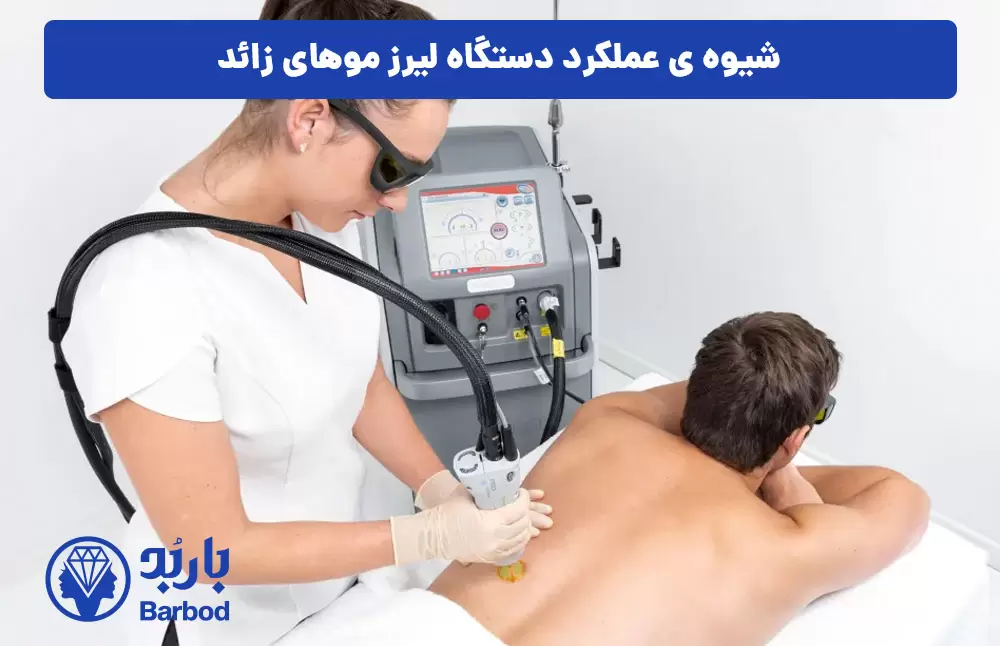 شیوه-ی-عملکرد-دستگاه-لیرز-موهای-زائد
