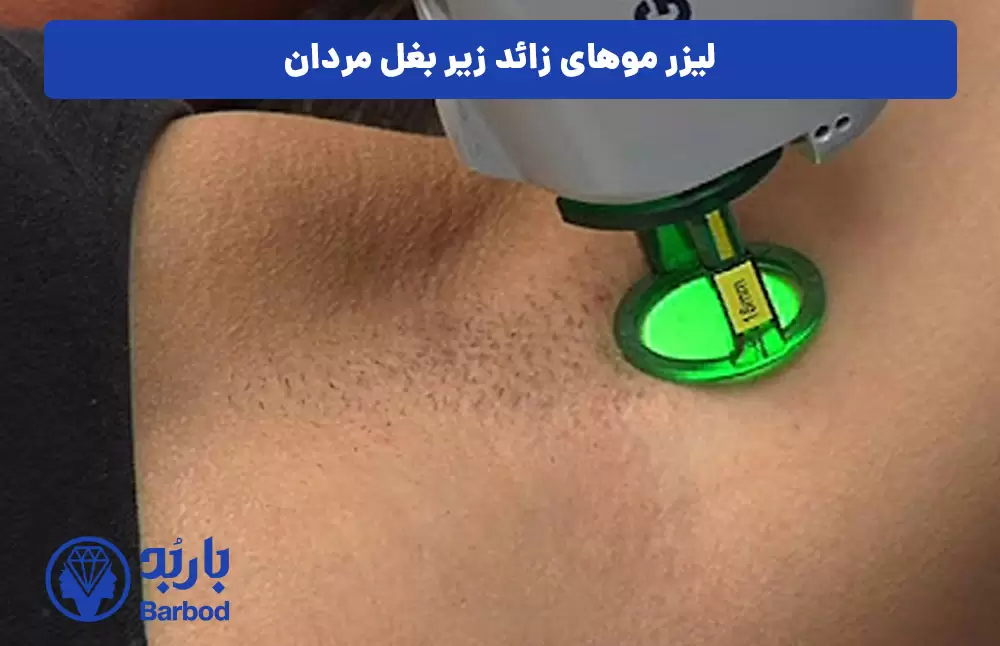 لیزر-موهای-زائد-زیر-بغل-مردان